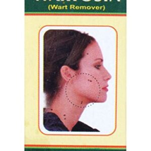 Wartosin Ayurvedic Wart Remover cream